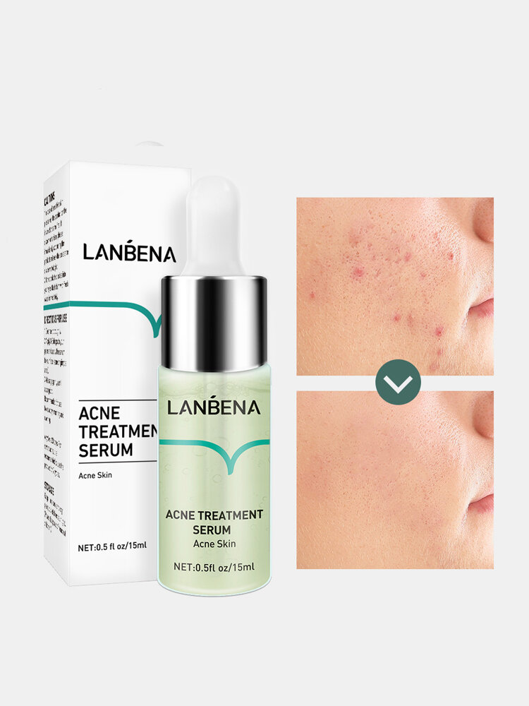 Acne Treatment Serum Oilgopeptide Anti Acne Reduce Mark Shrink Pores Deep Repair Strengthen Skin Bottom от Newchic WW