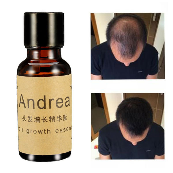 

Fast Hair Growth Essence Liquid Treament Original Authentic 100% Hair Loss Essential Oil 20ml