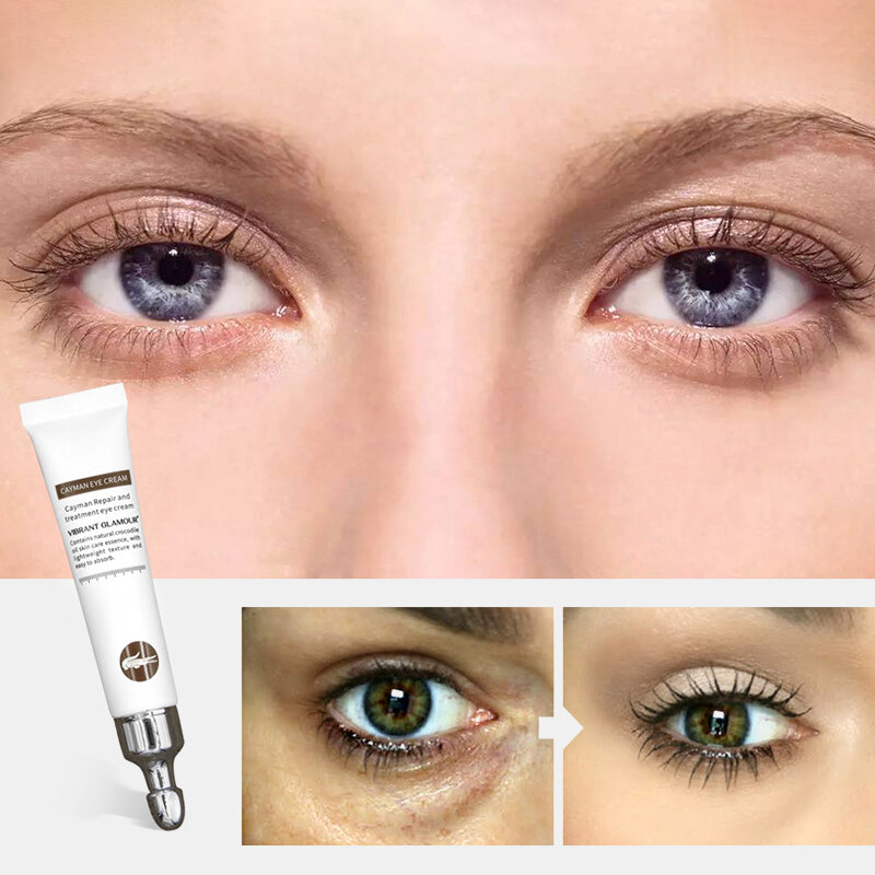 

Remove Eye Bags Fat Grain Eye Cream Lightens Dark Circles Anti Wrinkle Eye Cream