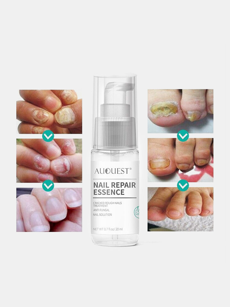 20ml Nail Repair Essence Antifungal Nail Toenail Treatment Nourishing Antifungal Nail Health Care
