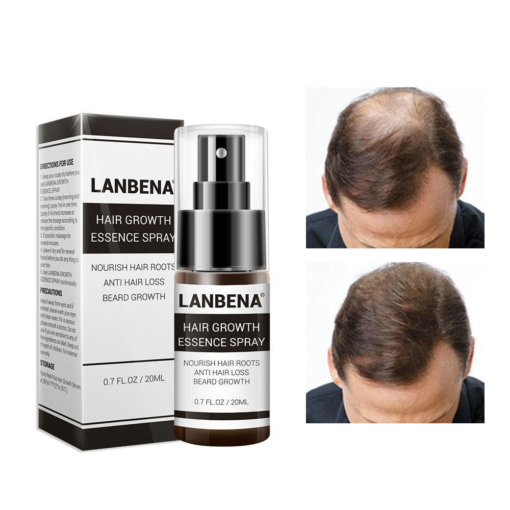 

Rapid Growth Hair Essence Spray Anti Hair Loss Hair Care 100% Natural Herbal Extract Essence Spray