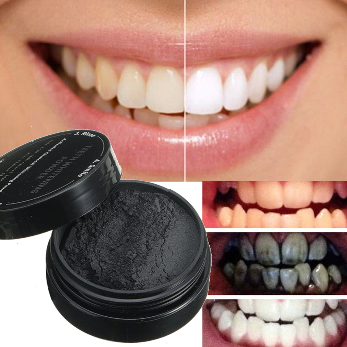 уголь для отбеливания зубов в домашних условиях